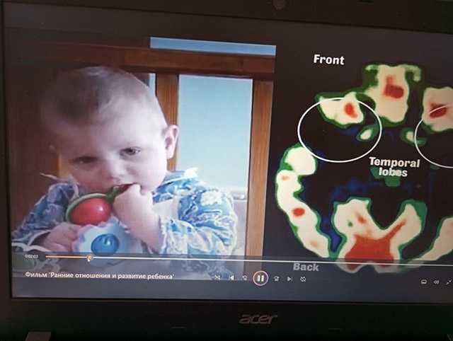 Неделя сохранения здоровья головного мозга