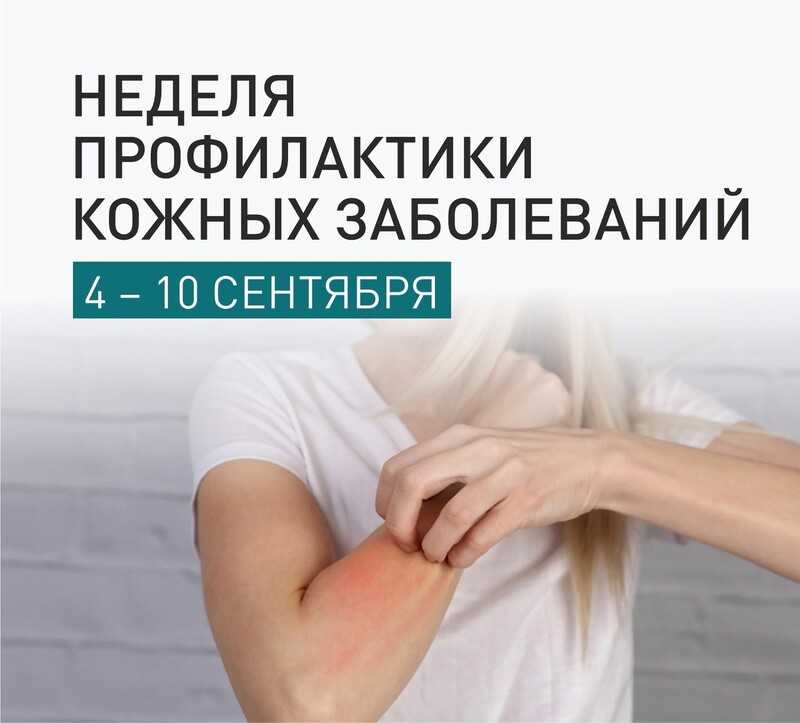 Неделя профилактики кожных заболеваний