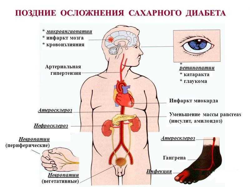 «Школа здоровья для проживающих с СД 2типа».